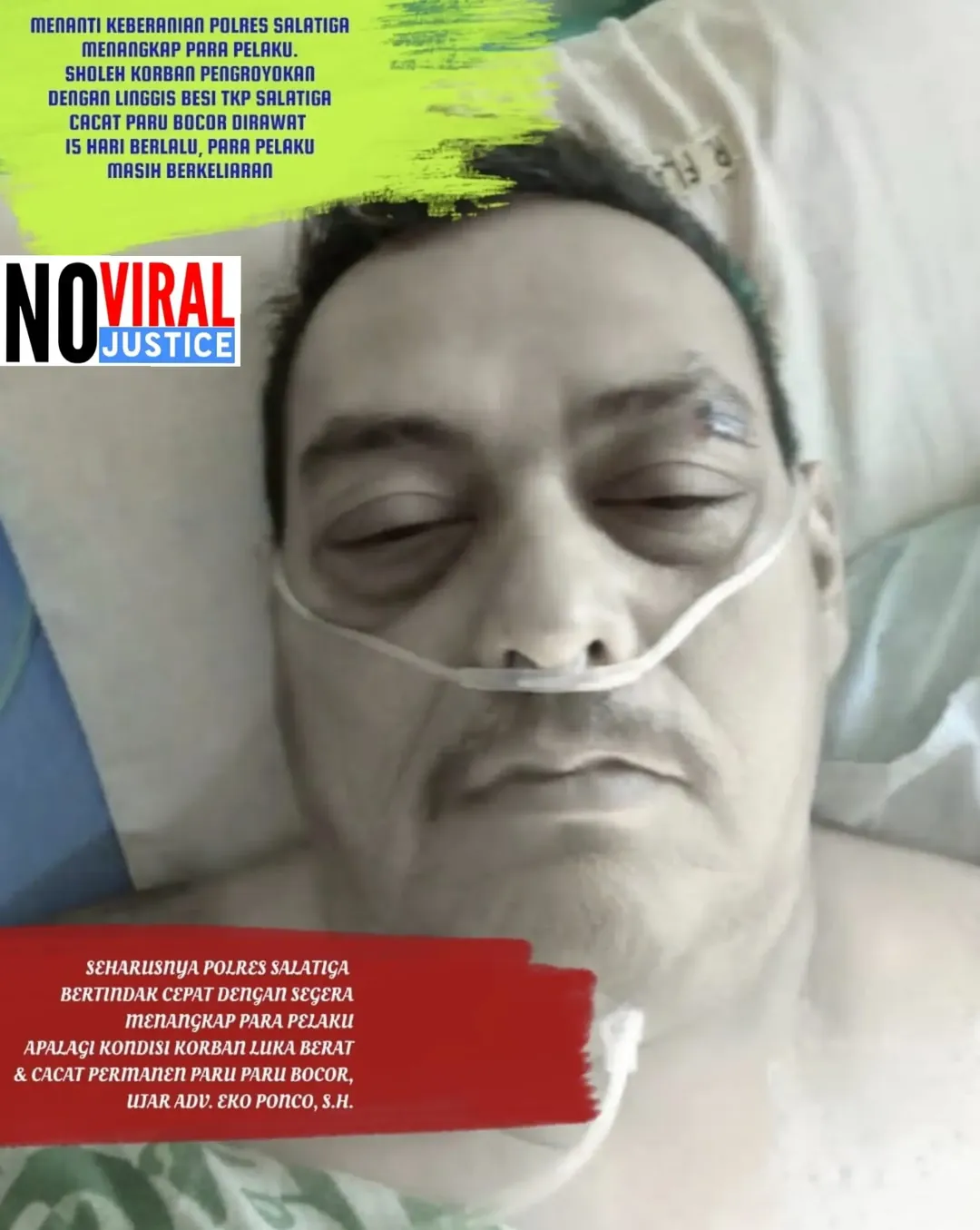 Sholeh Korban Pengroyokan Dgn Linggis Besi Kondisi Memburuk & Cacat Paru Bocor, Polres Salatiga Belum Menangkap Pelaku². 15 hari berlalu